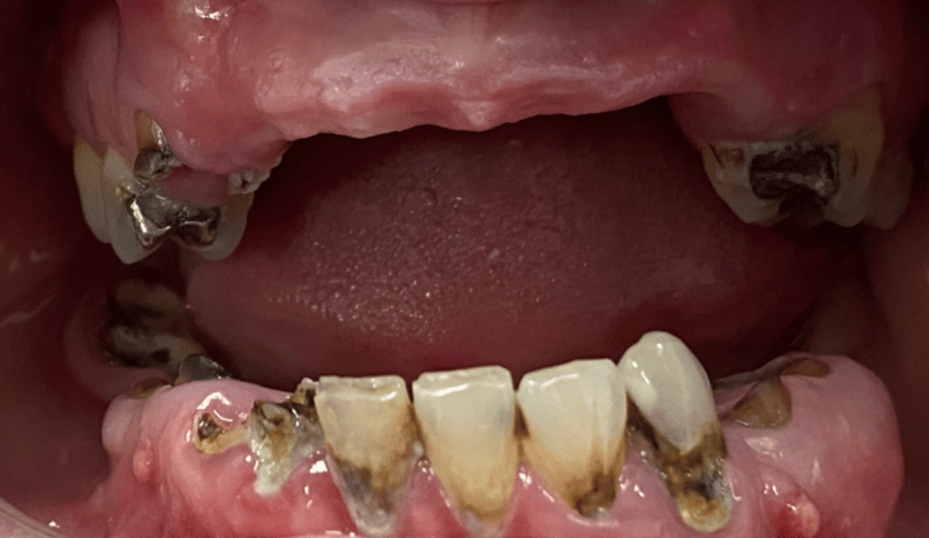 Before - Birmingham Dental Excellence