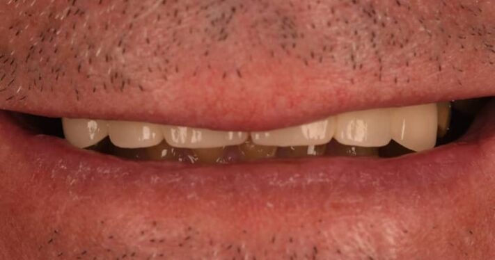 Before - Birmingham Dental Excellence