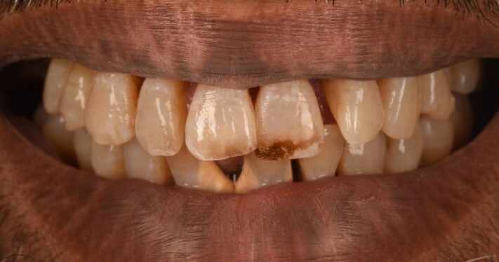 Before - Birmingham Dental Excellence